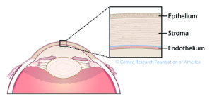 limbal xsection2