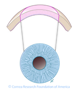 standard-PK-co-1-250x300